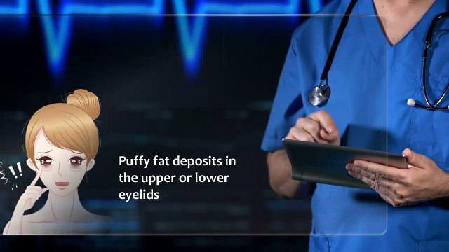 Blepharoplasty - A Plastic Surgery For Correcting Eyelids Defects