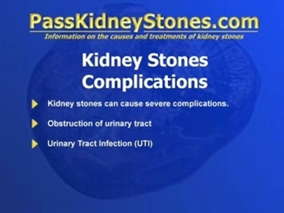 Kidney Stones Complications
