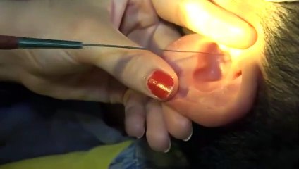 상록출장안마 -후불100%ョOiOE7685E6221｛카톡PP888｝ 상록전지역출장안마 상록오피걸 상록출장마사지 상록출장안마 상록출장마사지 상록출장콜걸샵안마け≜⻚