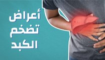 أعراض تضخم الكبد