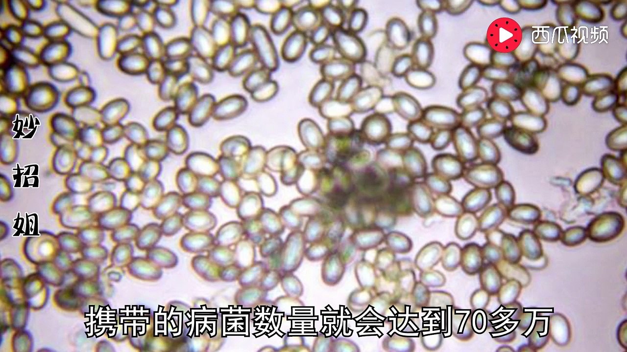 【Cleaning the washing machine】洗衣机几个月不洗比马桶还脏，教你一...
