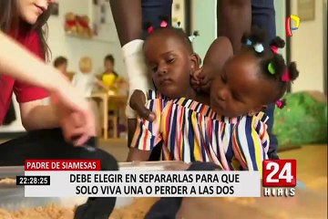 Reino Unido: padre de siamesas tendrá que decidir si sobrevive una o mueren ambas