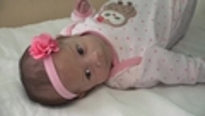 Video: bebé sobrevive a cirugía en México tras nacer con grave tumor