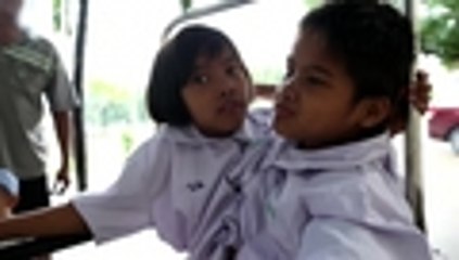 La historia de las siamesas de Tailandia que no quieren ser separadas