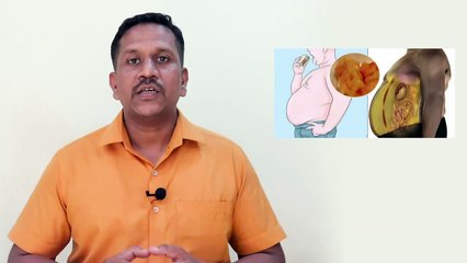 पोटावरची चरबी कमी करण्याचा सोप्पा उपाय