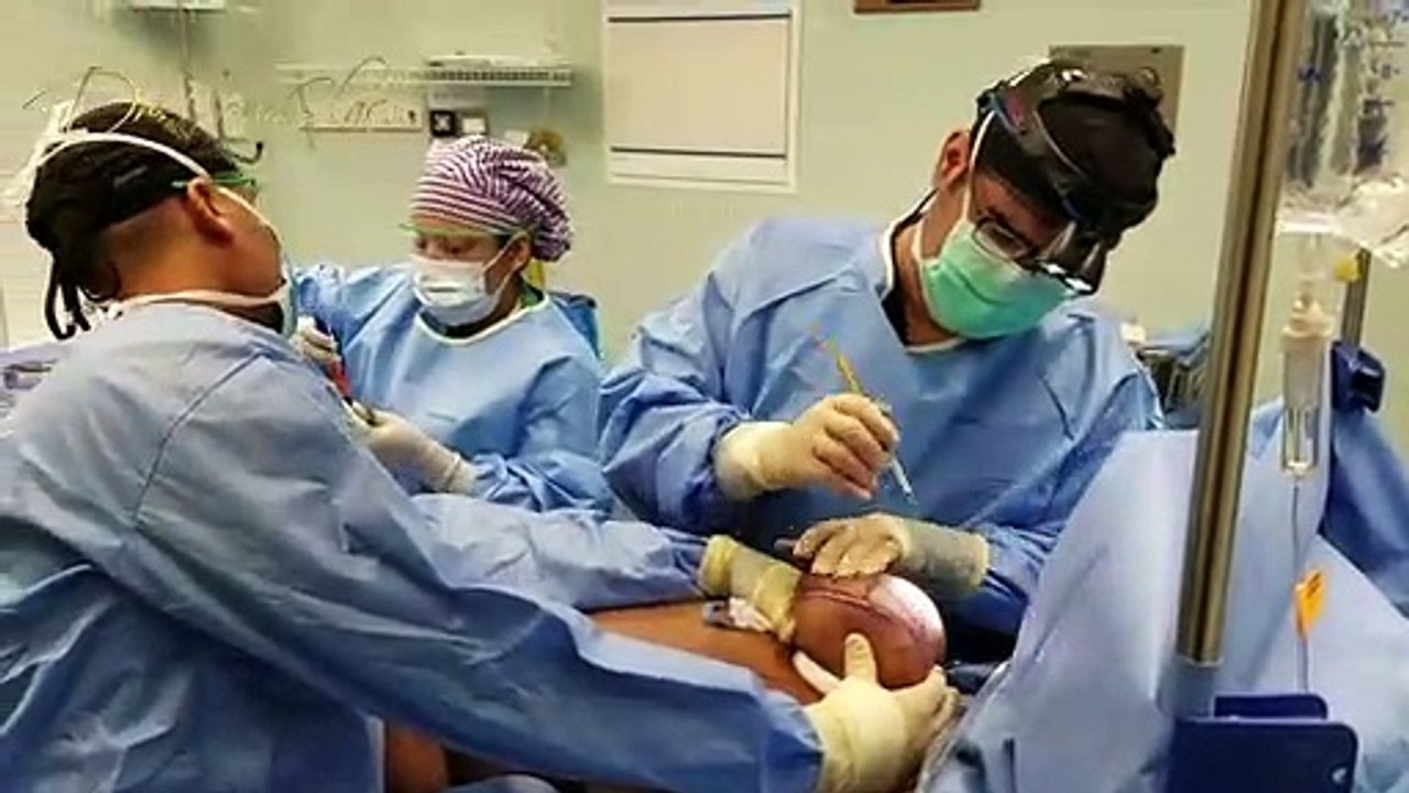 Swollen breasts after breast reduction