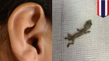 生きたヤモリが耳の中に侵入 タイ - トモニュース