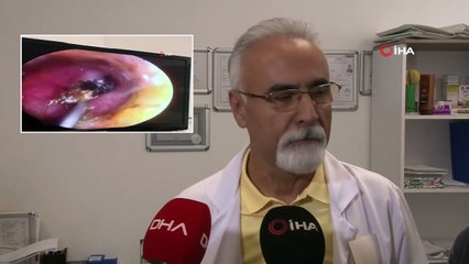 Kulağından Canlı Kelebek Çıktı