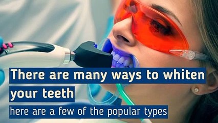 6 Smile Makeover With Teeth Whitening Types