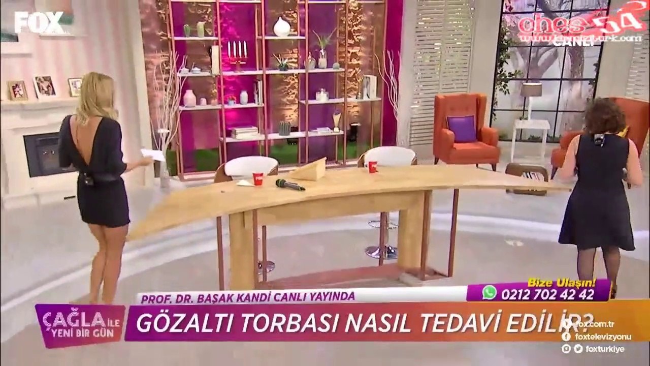 Çağla Şikel Black Mini Skirt Amazing Legs!