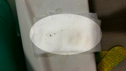 포항 '흐린 수돗물' 망간 때문...시민 '불안' / YTN