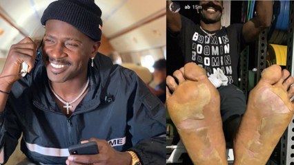 Antonio Brown Is Already GHOSTING The Raiders After He DISAPPEARS Following Foot Injury!