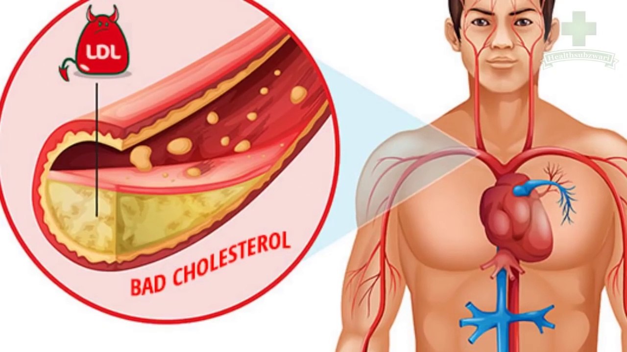 6 FOODS THAT WILL CLEAN YOUR ARTERIES FROM BAD CHOLESTEROL