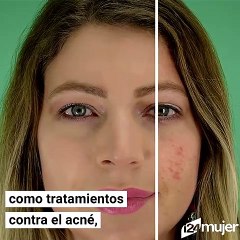 Mujer asegura que beber su propia orina ha sido el mejor tratamiento de belleza en los último 10 años