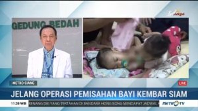 Bayi Kembar Siam Asal Kendari Jalani Operasi Pemisahan Besok Pagi