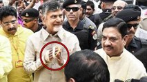 చంద్రబాబు చేతికి కట్టు || Chandrababu Naidu Suffering With Hand Pain || Oneindia Telugu