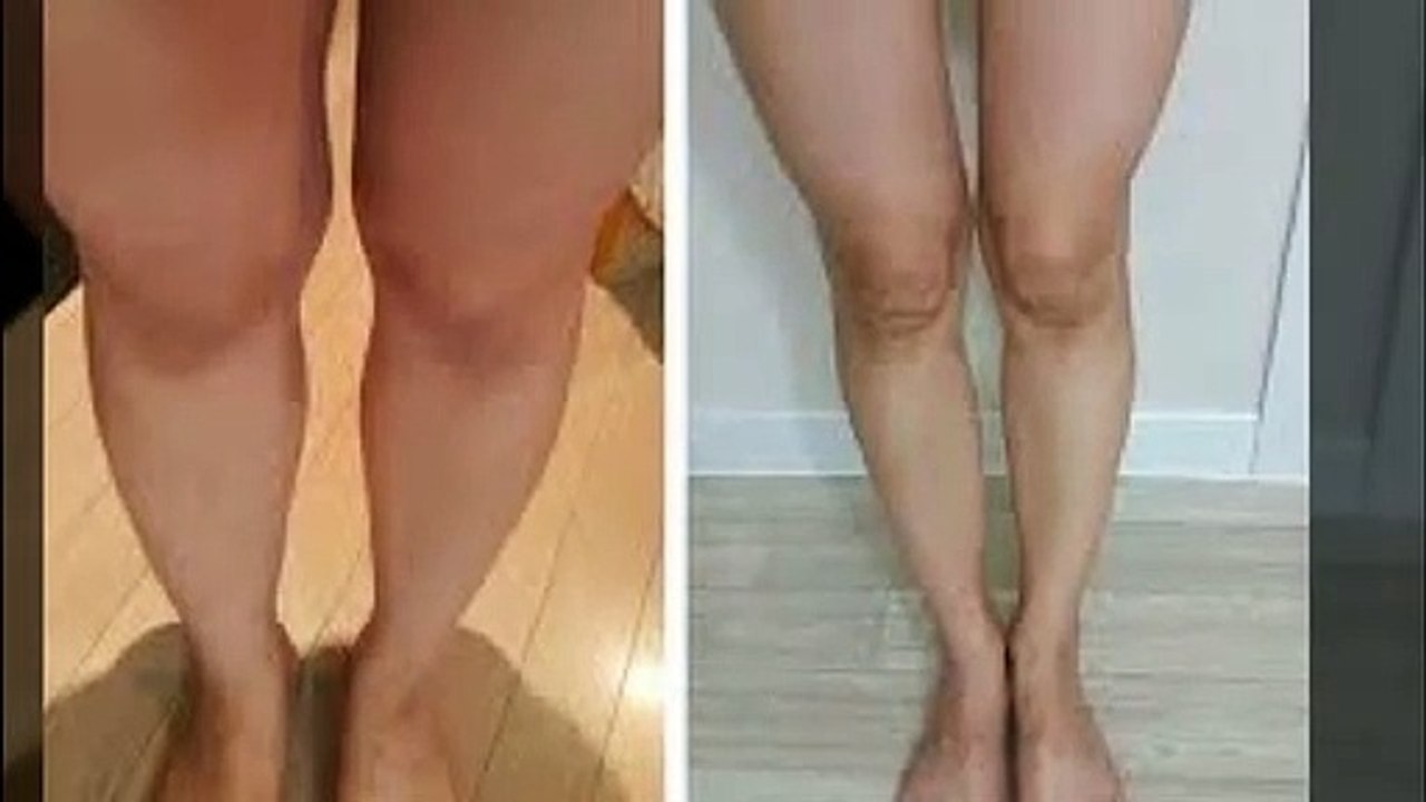 광명출장안마 -후불100%ョOiOV8264V5054｛카톡JJ35｝ 광명전지역출장안마 광명오피걸 광명출장마사지 광명출장안마 광명출장마사지 광명출장콜걸샵안마 광명출장아로마₭ч℃