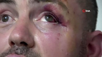 Bursa'da yüzde 92 engeli bulunan gaziye, ayaklarını uzattığı için dayak attılar