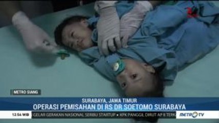 Bayi Akila dan Azila Jalani Operasi Pemisahan