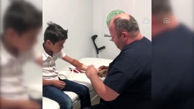 Suriyeli Muhammed, protez eline kavuştu