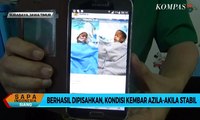 Berhasil Dipisahkan, Kondisi Kembar Azila-Akila Stabil