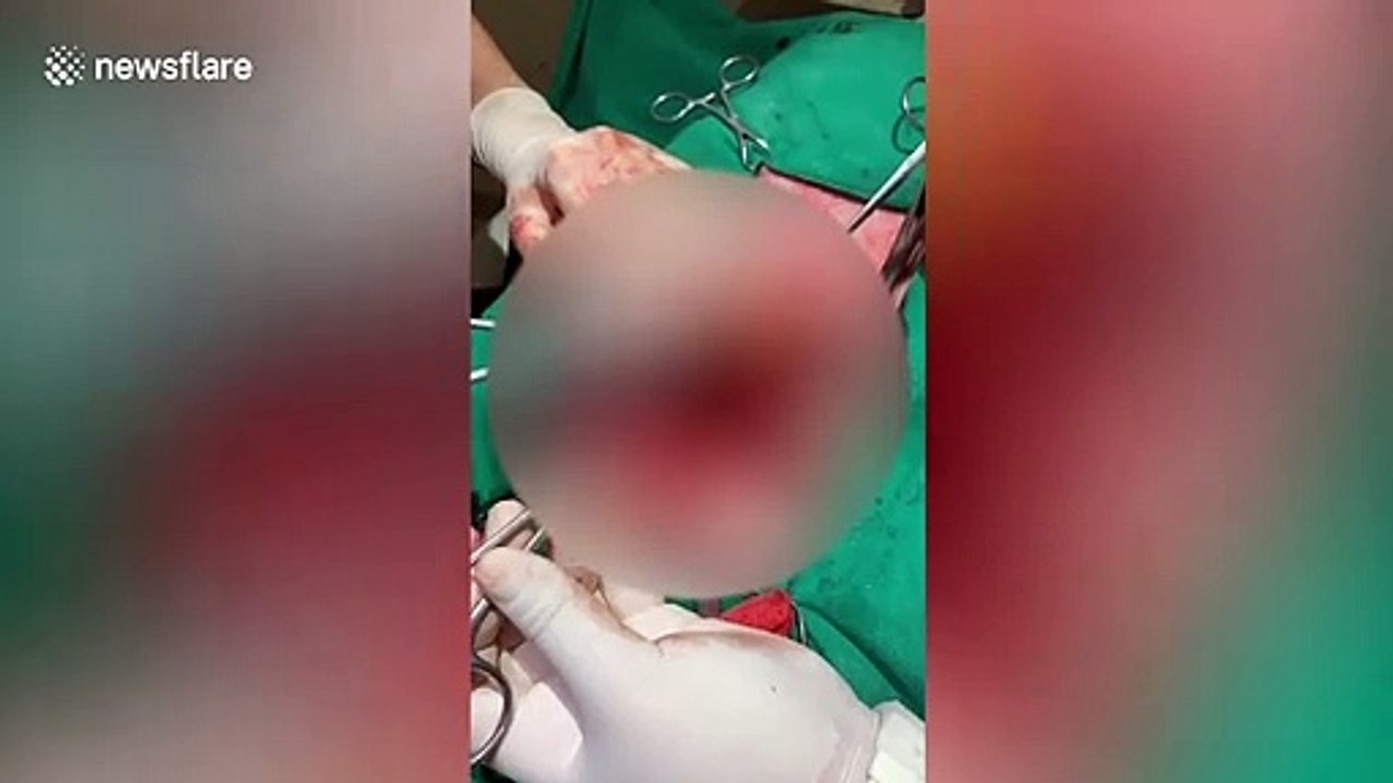 Vets remove 32 RUBBER DUCKS from greedy bulldog's tummy