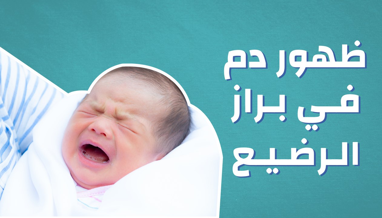 ظهور دم في براز الرضيع