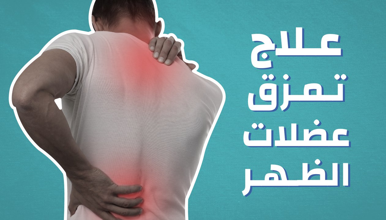 علاج تمزق عضلات الظهر