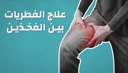 علاج الفطريات بين الفخذين