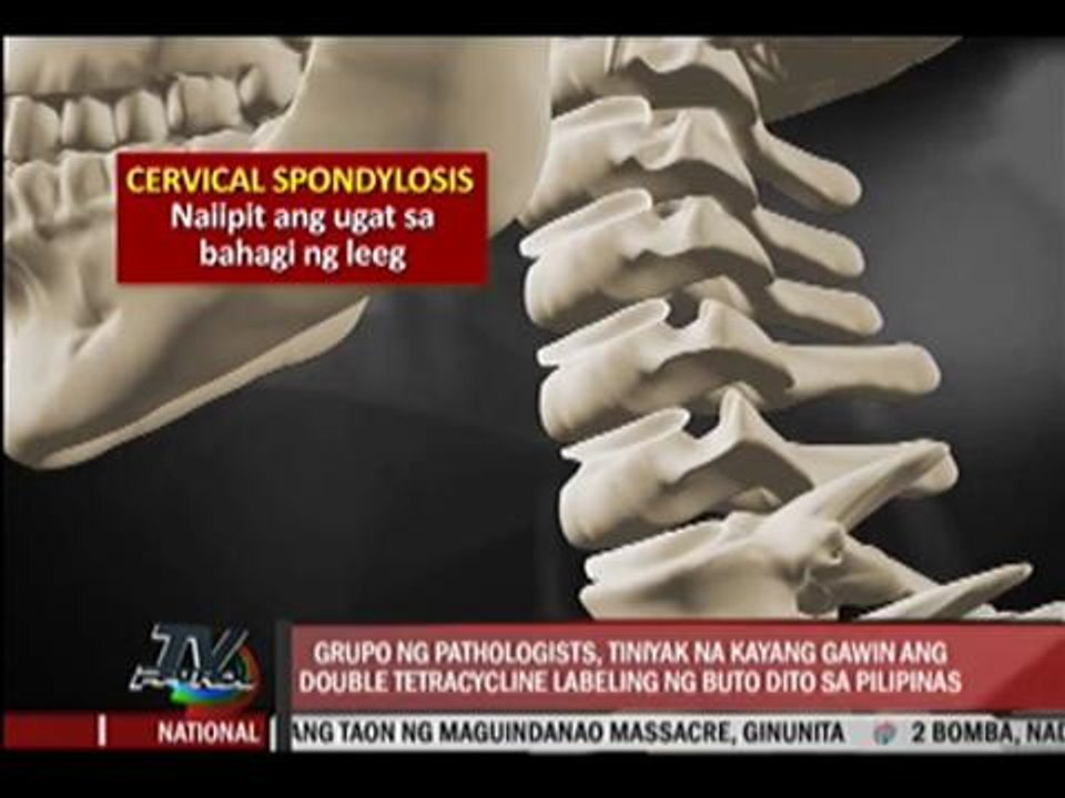 Pathologists urge GMA docs to 'tell truth'