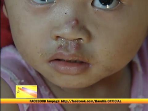 Health experts warn of summer diseases