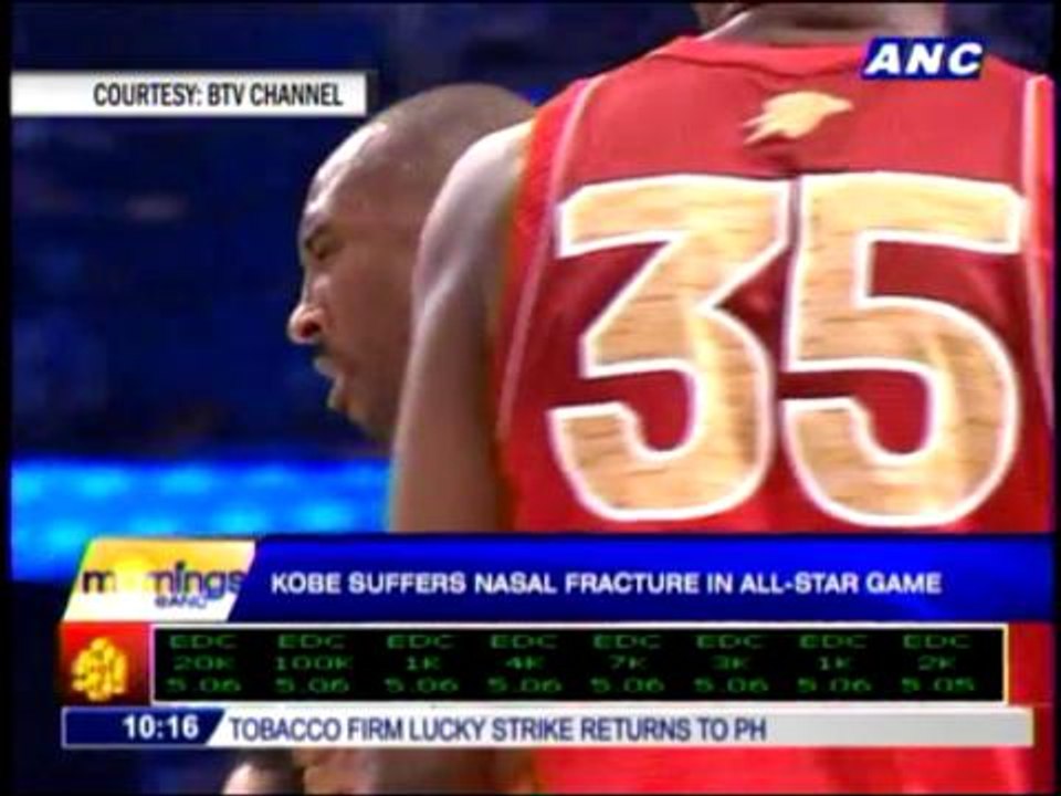 Bryant suffers nasal fracture in All-Star Game