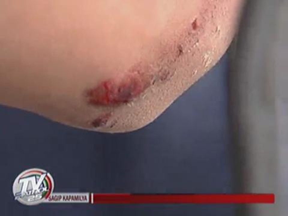 Farmers' coco levy protest turns violent