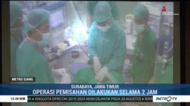 Bayi Akila-Azila Berhasil Jalani Operasi Pemisahan