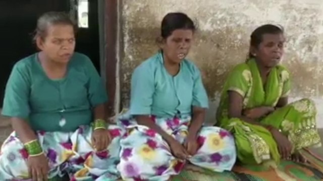 ಕಣ್ಣು ಕಾಣೊಲ್ಲ ಆದ್ರು ಪ್ರತಿಭೆಗೆ ಯಾವುದೇ ಕೊರತೆ ಇಲ್ಲ..? | Oneindia Kannada