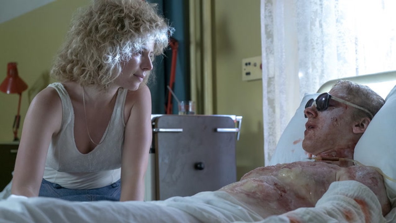How HBO's 'Chernobyl' Recreated the Horrific Radiation Burns - Variety Artisans