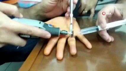 Parmağındaki yüzüğü çıkartamayan kadının imdadına AFAD yetişti