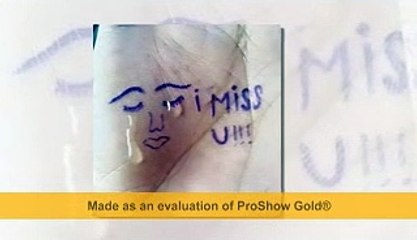 كل الحكاية ان الوجع  عايش معي