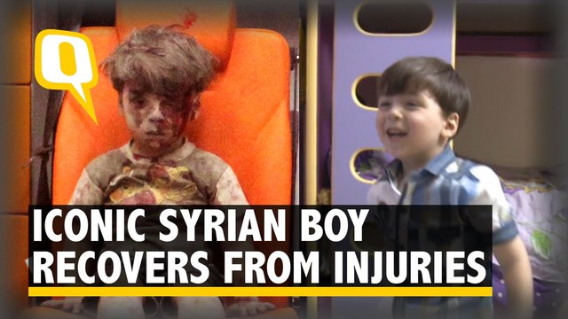 Syrian Boy Clicked in Iconic Aleppo Photo Has Now Recovered