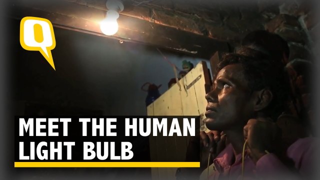 'Whether It's 25,000 Volts or 11,000 Volts, I Can Touch it'