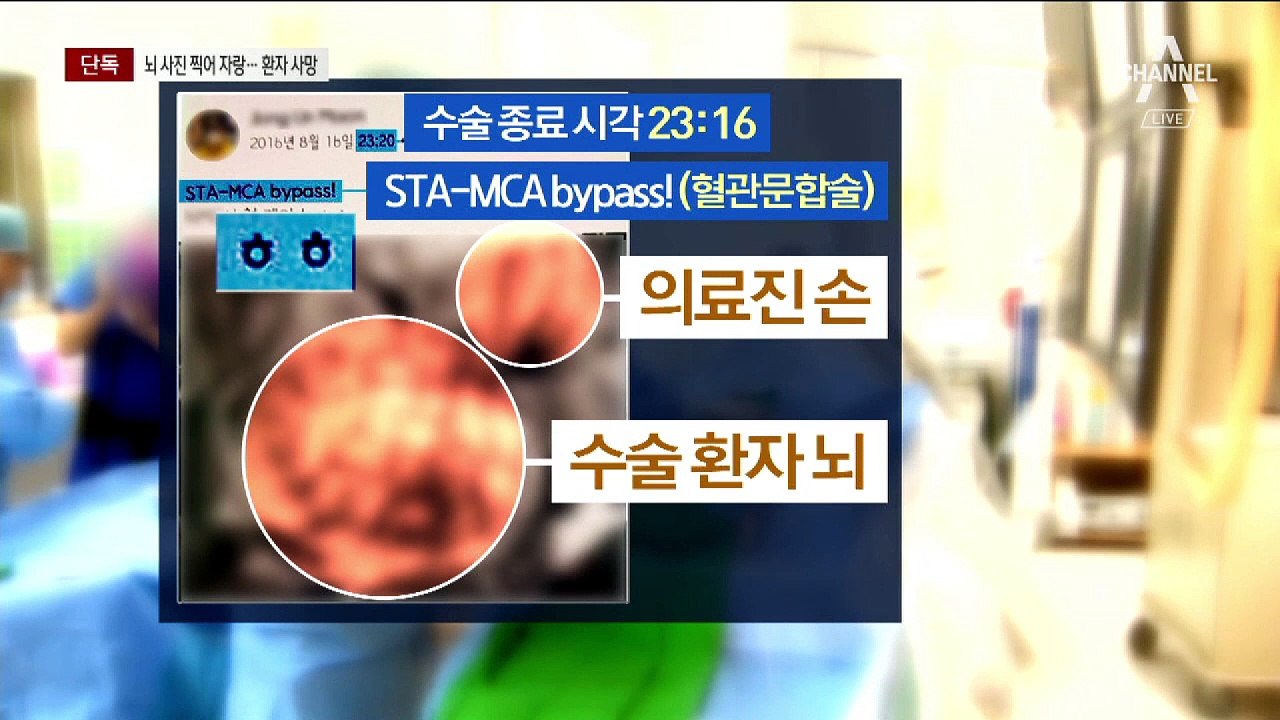 [단독]뇌 사진 SNS에 자랑한 국립병원 의사…환자, 사흘 뒤 사망