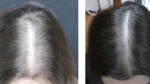 Rose Water For Damaged Hair Growth | गुलाबजल के इस्तेमाल से बालों का झड़ना रोकें | Boldsky