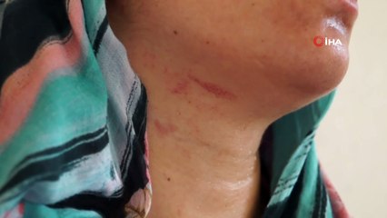 Babasından kalan mirası reddeden 8 aylık hamile kadının, eşi ve amcası tarafından darp edildiği iddiası