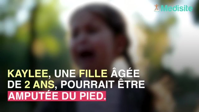 Une petite-fille, ébouillantée par sa grand-mère par alliance, risque l’amputation.