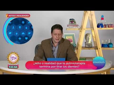 Mitos y realidades: ¿Las raíces de los dientes se puede afectar con los brackets? | Sale el Sol