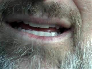 Commuter's VLOG January 28 2008 - The Commuters TEETH!
