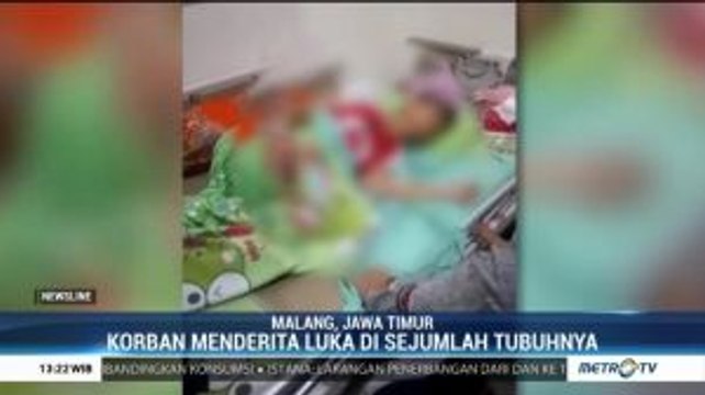 Siswa SMP di Malang Jadi Korban Perundungan Teman Sekolahnya