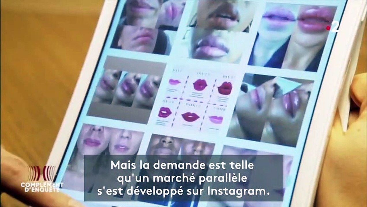 Injections à moitié prix dans une cuisine de banlieue : "Complément d'enquête" dans un cabinet d'esthétique clandestin