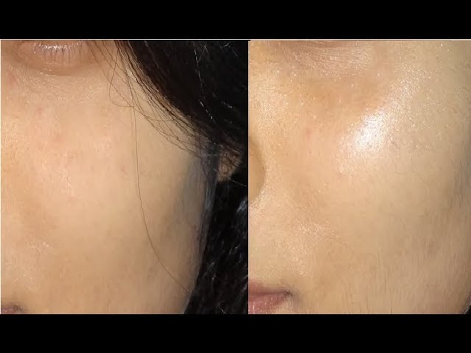 हिंदी _ Papaya Facial At Home    Get Glowing Healthy skin