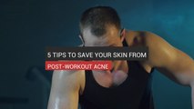 5 Tips To Save Your Skin From Post-Workout Acne